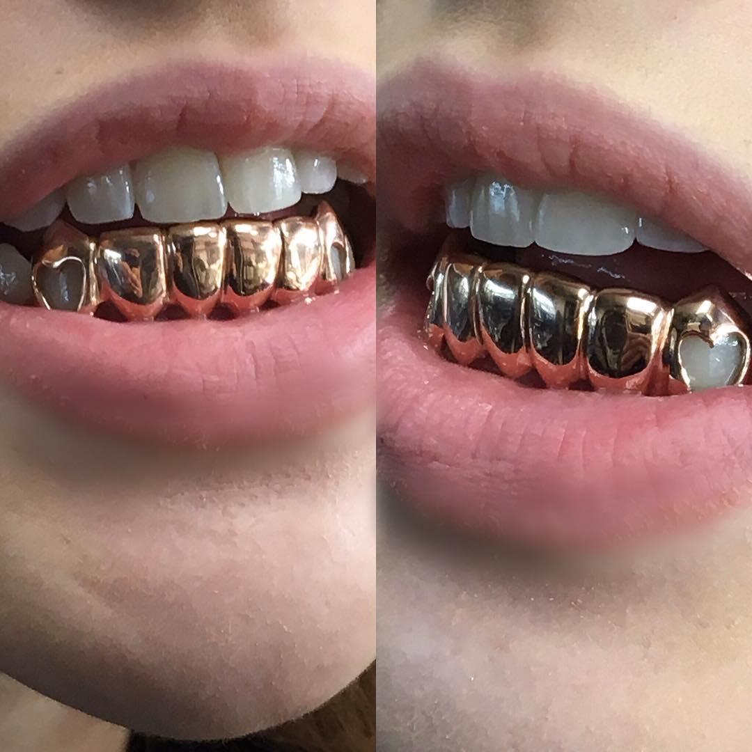 Client piece