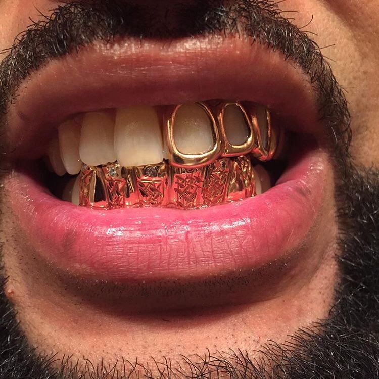 Yuro Customs piece