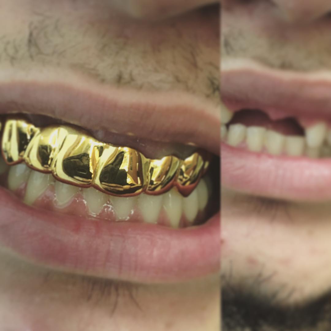 Client piece