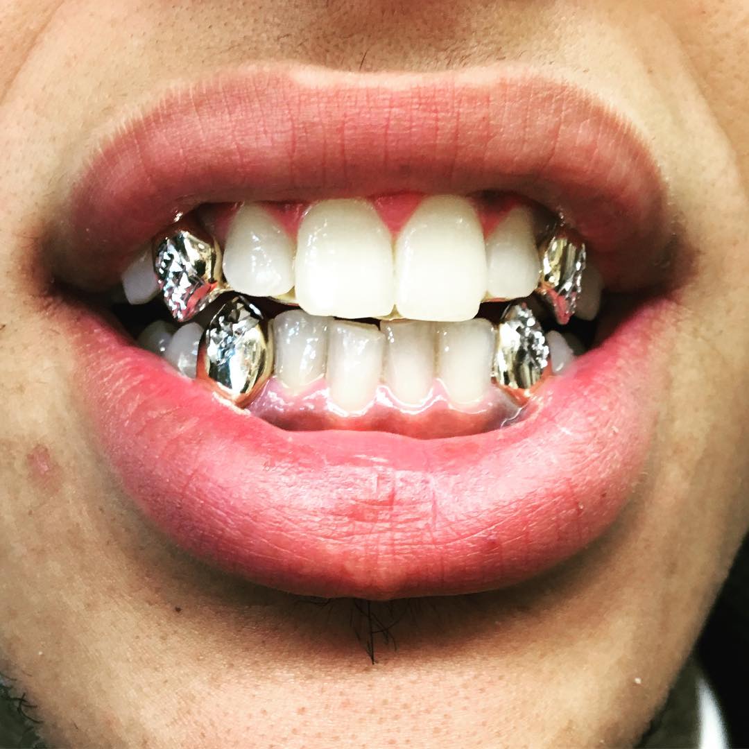 Client piece