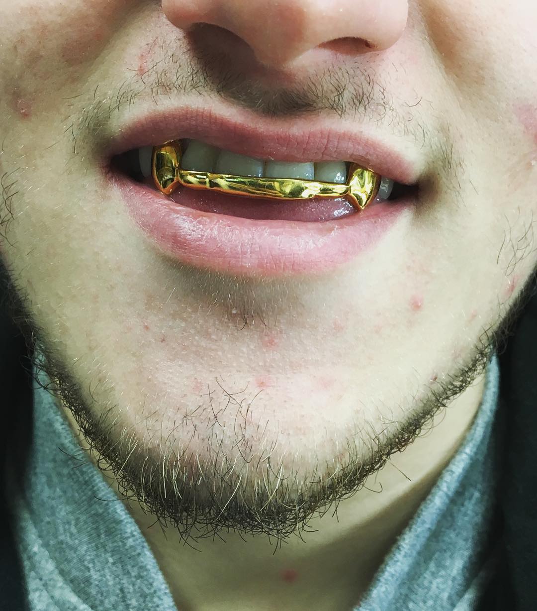 Client piece