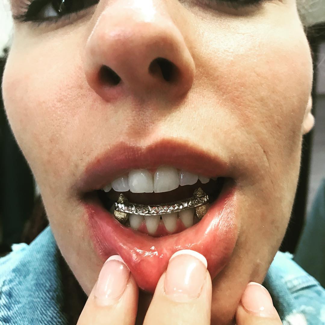 Client piece