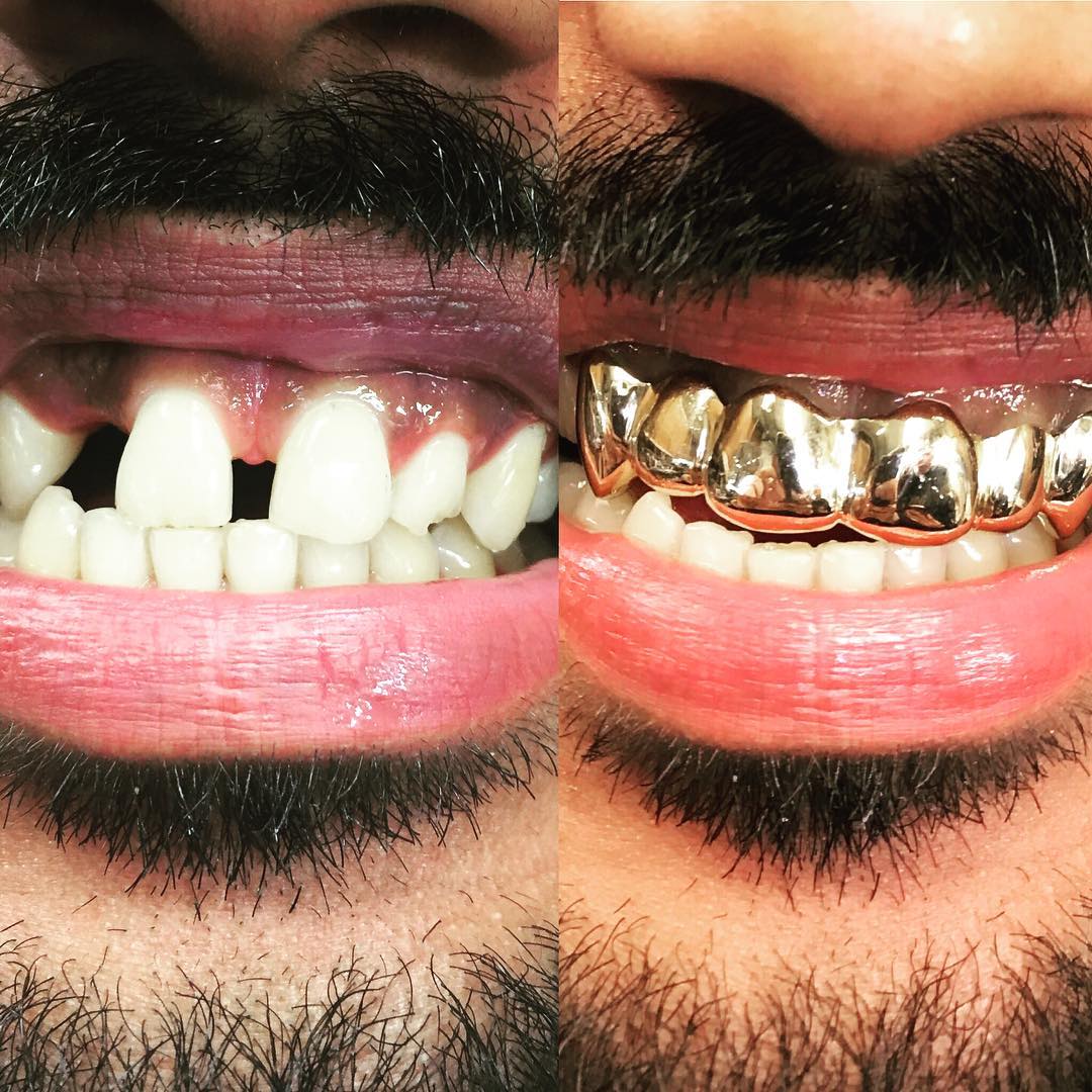 Client piece