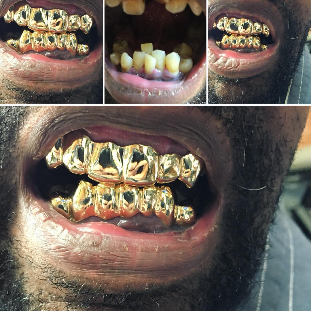 Client piece