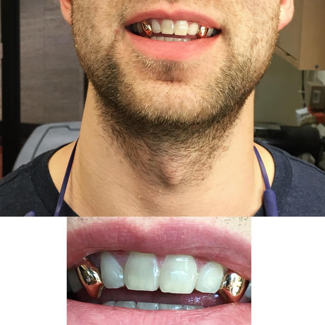 Client piece