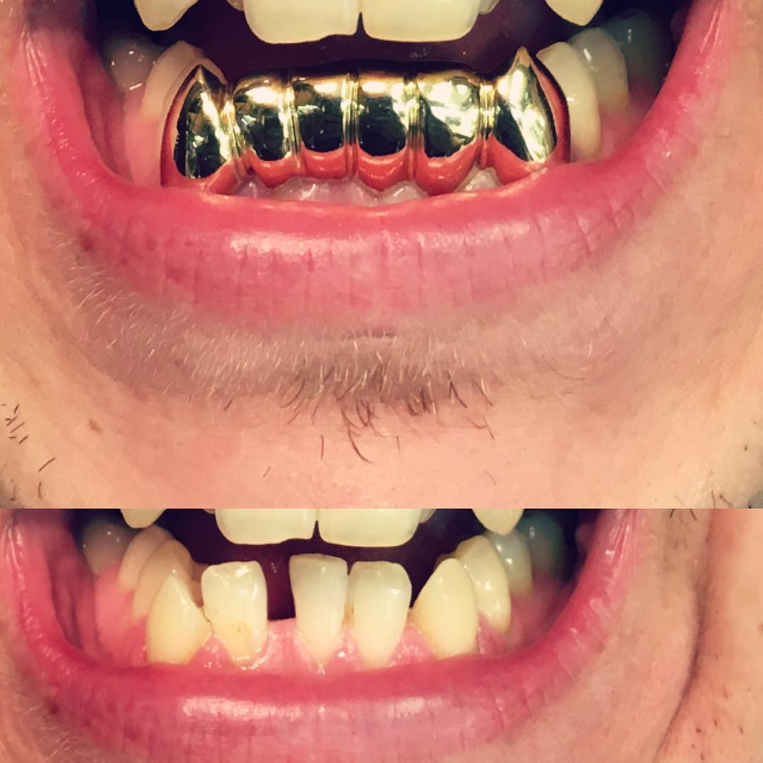 Client piece
