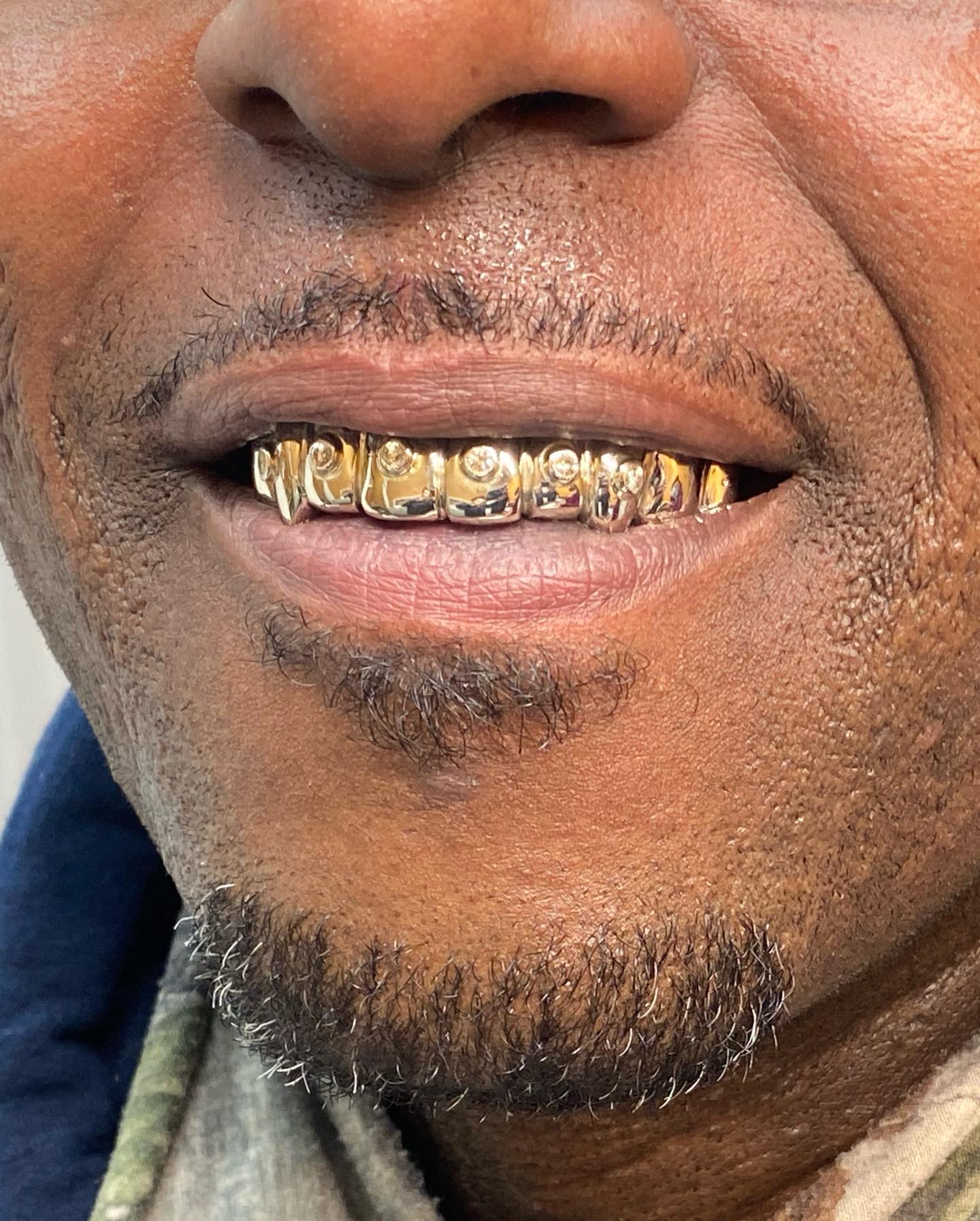 Client piece